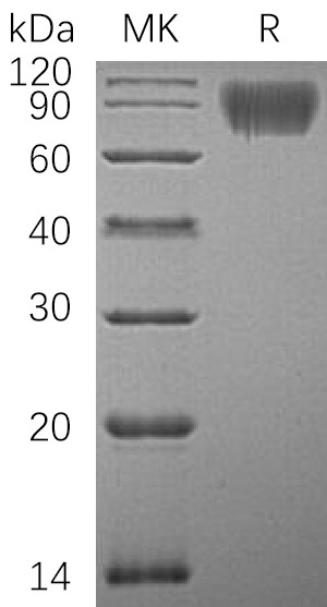 Human ICAM-1 +SDS-PAGE-1.jpg
